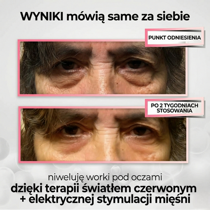 Revital® – Terapia oczu światłem + EMS